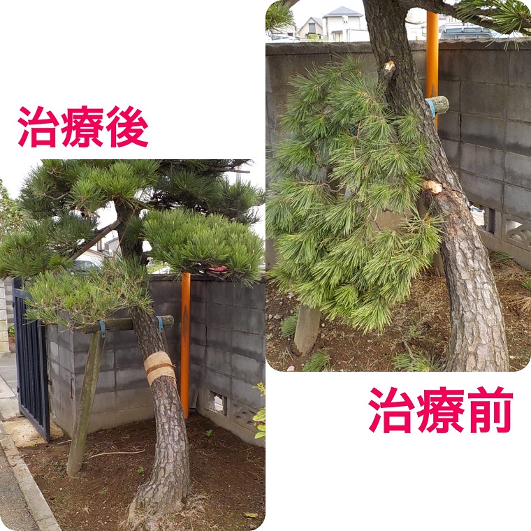樹木補修作業